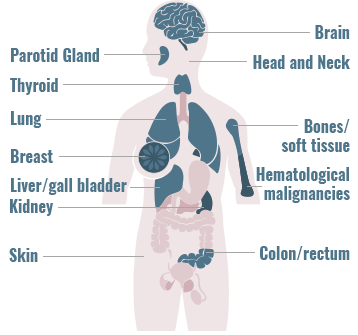 Distribution of NTRK gene fusions across primary tumor sites graphic
